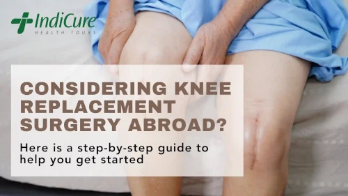 Your Guide to Knee Replacement Surgery Abroad
