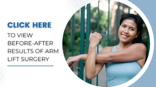 view-before-after-results-of-arm-lift-surgery