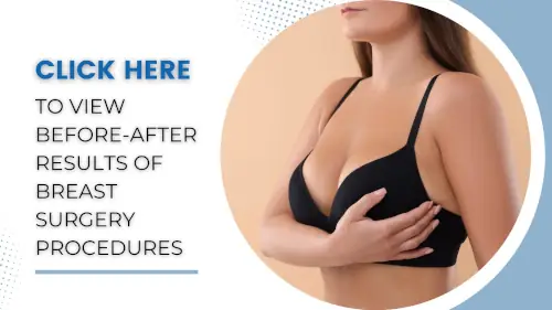 view-before-after-results-of-breast-surgery-procedures