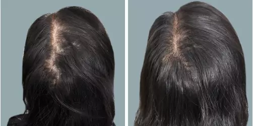 Before and After