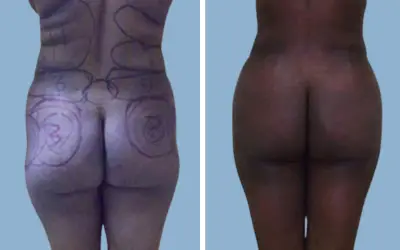 Before and After