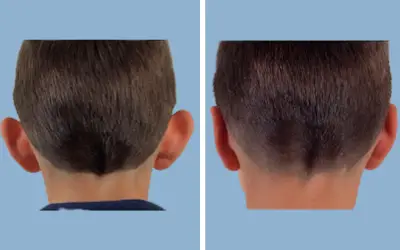 Before and After