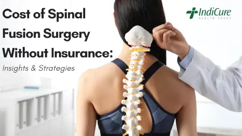 Cost of Spinal Fusion Surgery Without Insurance Cost of Spinal Fusion Surgery Without Insurance