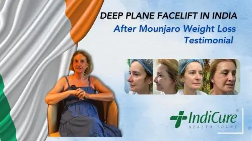 Deborah's Transformative Deep Plane Facelift Journey After Mounjaro Weight Loss Deborah's Transformative Deep Plane Facelift Journey After Mounjaro Weight Loss