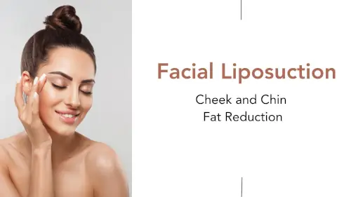 Facial Liposuction in India Facial Liposuction in India