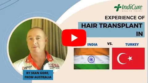 Hair Transplant Experience in India