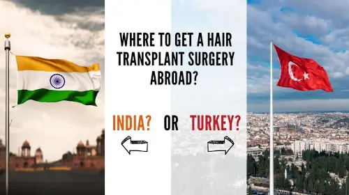 Where to get a Hair Transplant Surgery Abroad? India or Turkey?
