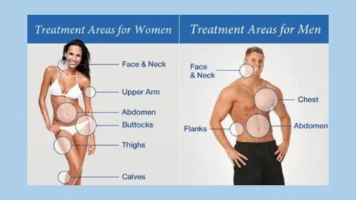 Multiple-Area Liposuction in India Multiple-Area Liposuction in India