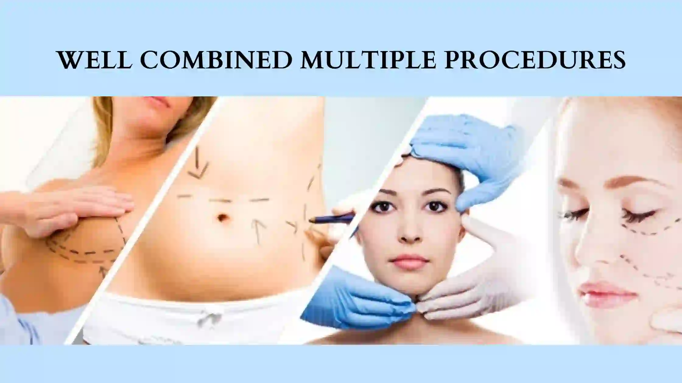 Well combined multiple aesthetic plastic surgery procedures