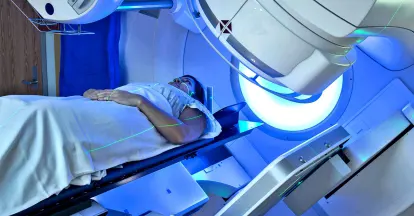 Radiotherapy (IMRT) in India | IndiCure