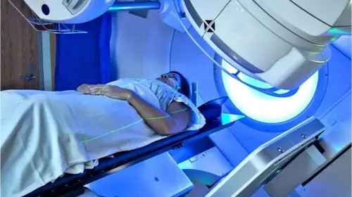 Radiotherapy (IMRT) in India | IndiCure