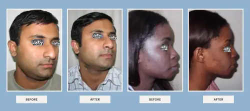 facial-procedures-before-after-3